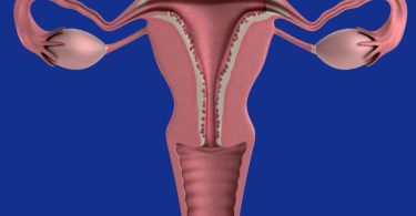 The significant difference between prolapsed bladder and prolapsed uterus indicates that prolapsed bladder is a medical disorder whereby the bladder droops downward. In contrast, the prolapsed uterus is a medical disorder whereby the uterus droops downwards. The pelvic floor ailment is a regular disorder that equivalently influences males and females of every age. Hence, it has been declared that 23.7 percent of females go through pelvic floor ailments, including urinary incontinence and pelvic organ prolapse, known as (POP). A pelvic prolapse is known as the sliding down or forward of a region of the pelvic organ. As such, prolapse bladder and prolapse uterus are two varied kinds of pelvic organ prolapse.